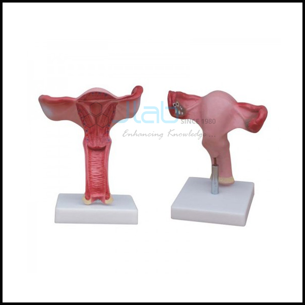 Magnified Uterus Model