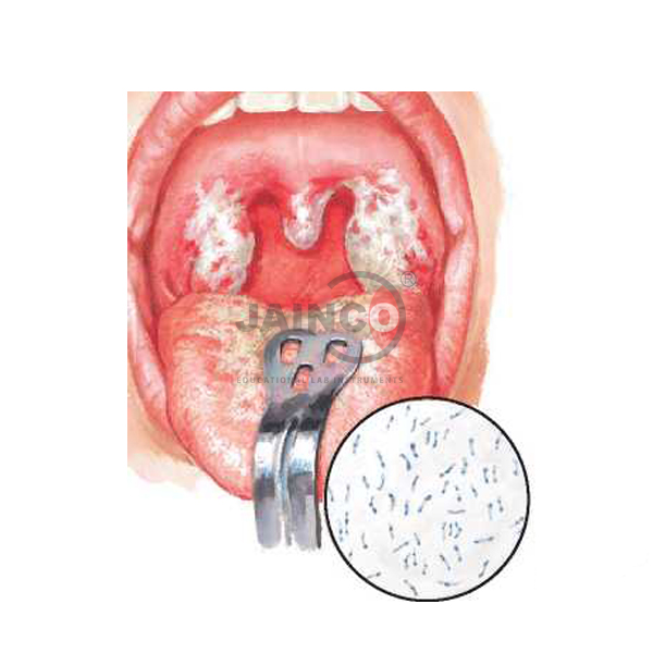 Diphtheria Model