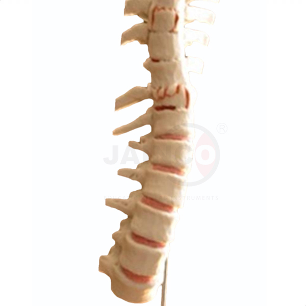 Fractured Spine Model