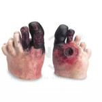 Diabetic Foot Model