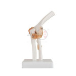 Elbow Joint Model