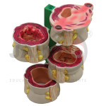 Colon Model Set of 4 Pcs
