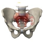 Pelvis Fracture Model